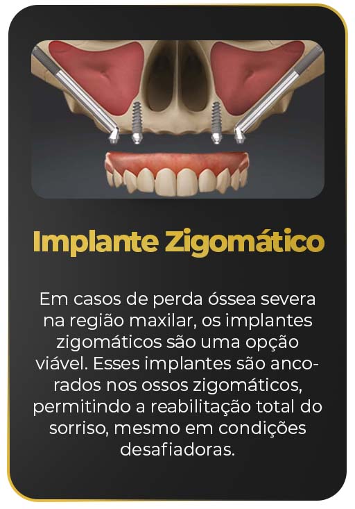 Zigomatico.jpg