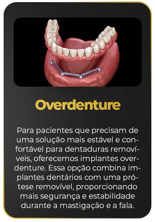overdenture.jpg